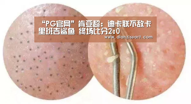 “PG官网”肯亚超: 迪卡联不敌卡里班吉鲨鱼 终场比分2:0(图1) PG官网